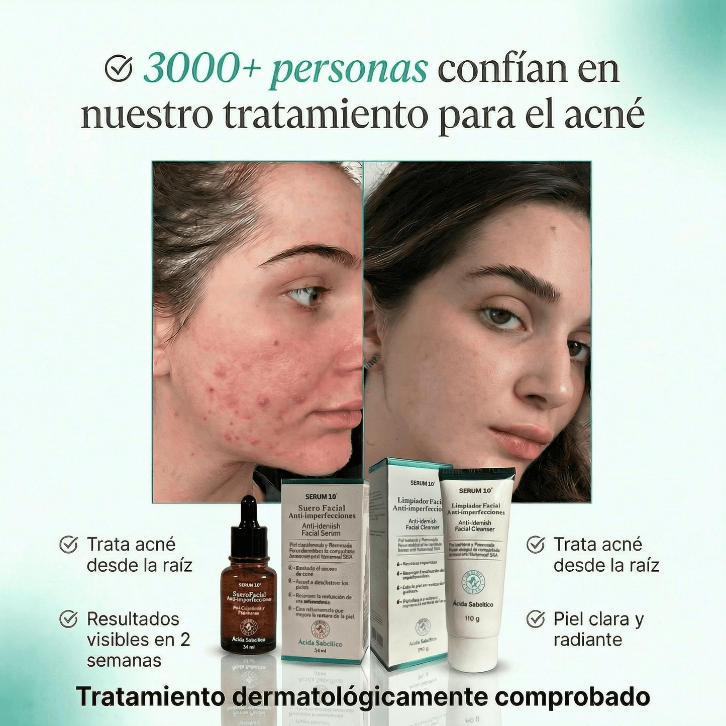 Anti-Acné Duo S10